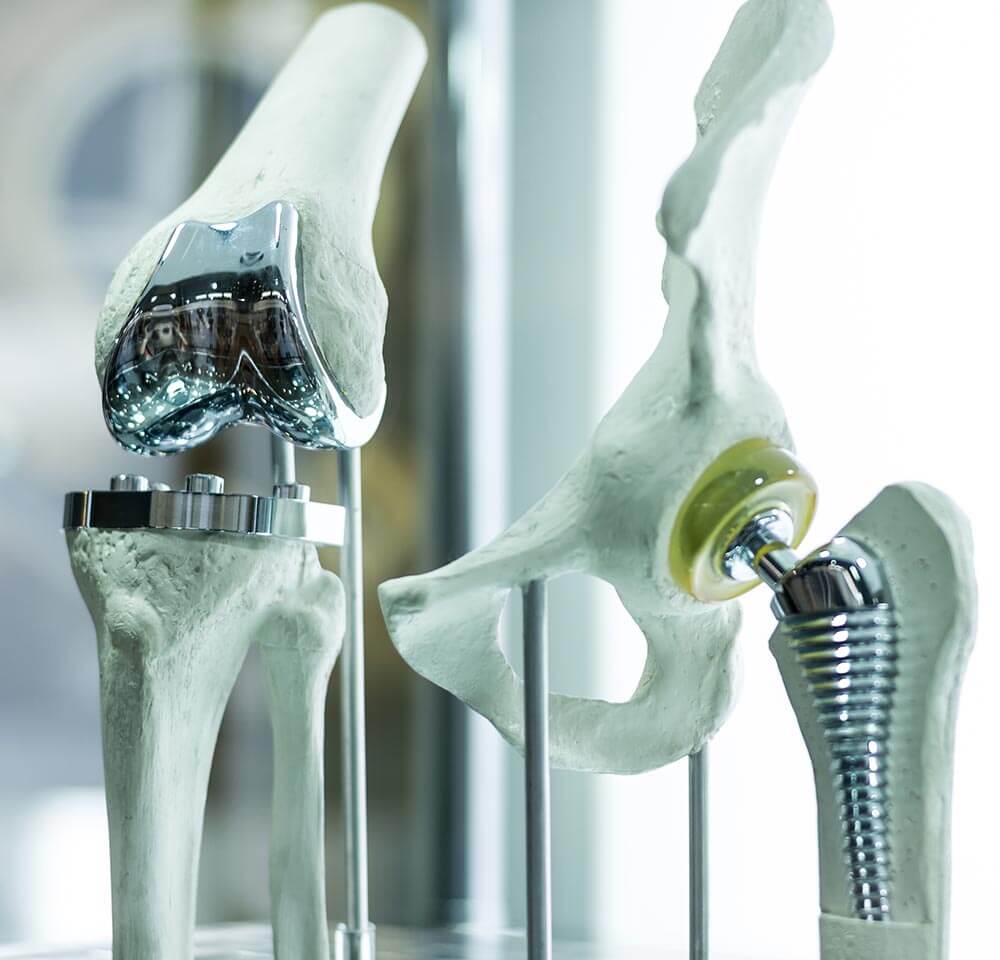 Diagram of bone joints